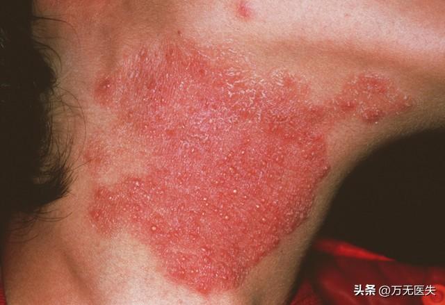 篮网会直接送出顶薪报价，但湖人也绝不想白白失去这位强力得分手